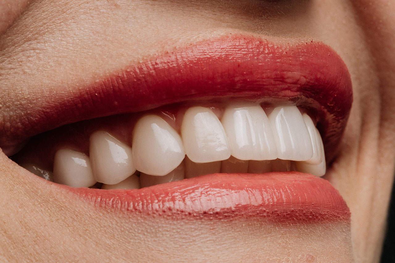 Jovens participam de triagem odontológica em ação da Turma do Bem e Colgate em diversos municípios do Brasil (Créditos: Bondart Photography/Shutterstock)